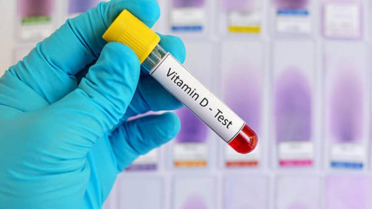 signs of low vitamin D